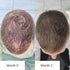 Brunette_Man_Before_And_After_Showcasing_Improvement_In_Hair_Growth_After_2_Months