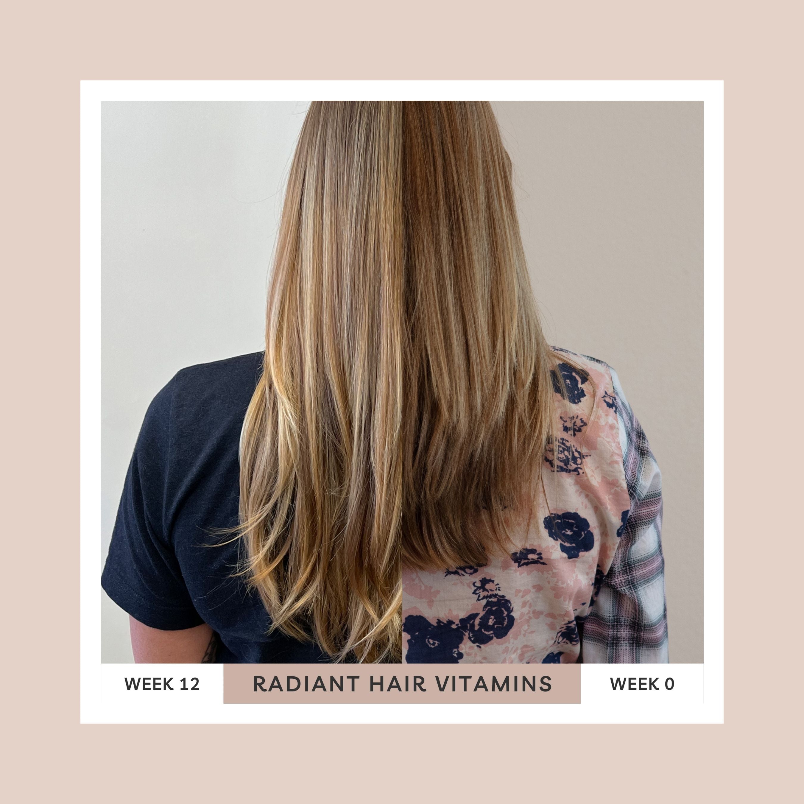 Radiant Hair Vitamins — Hair Growth & Shedding Support