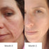 Woman_Before_And_After_Showcasing_Improvement_In_Skin_Texture_After_2_Months
