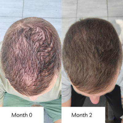 Radiant Hair Vitamins — Hair Growth & Shedding Support