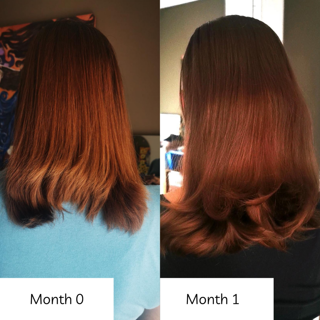 Radiant Hair Vitamins — Hair Growth & Shedding Support