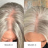 Aging_Woman_Before_And_After_Showcasing_Improvement_In_Hair_Growth_After_2_Months