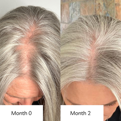 Radiant Hair Vitamins — Hair Growth & Shedding Support