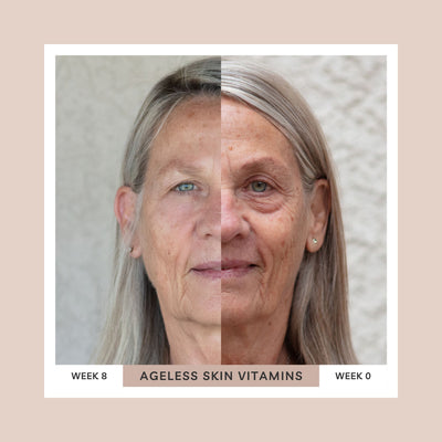 Ageless Skin Vitamins — Anti-Ageing Skin Supplement