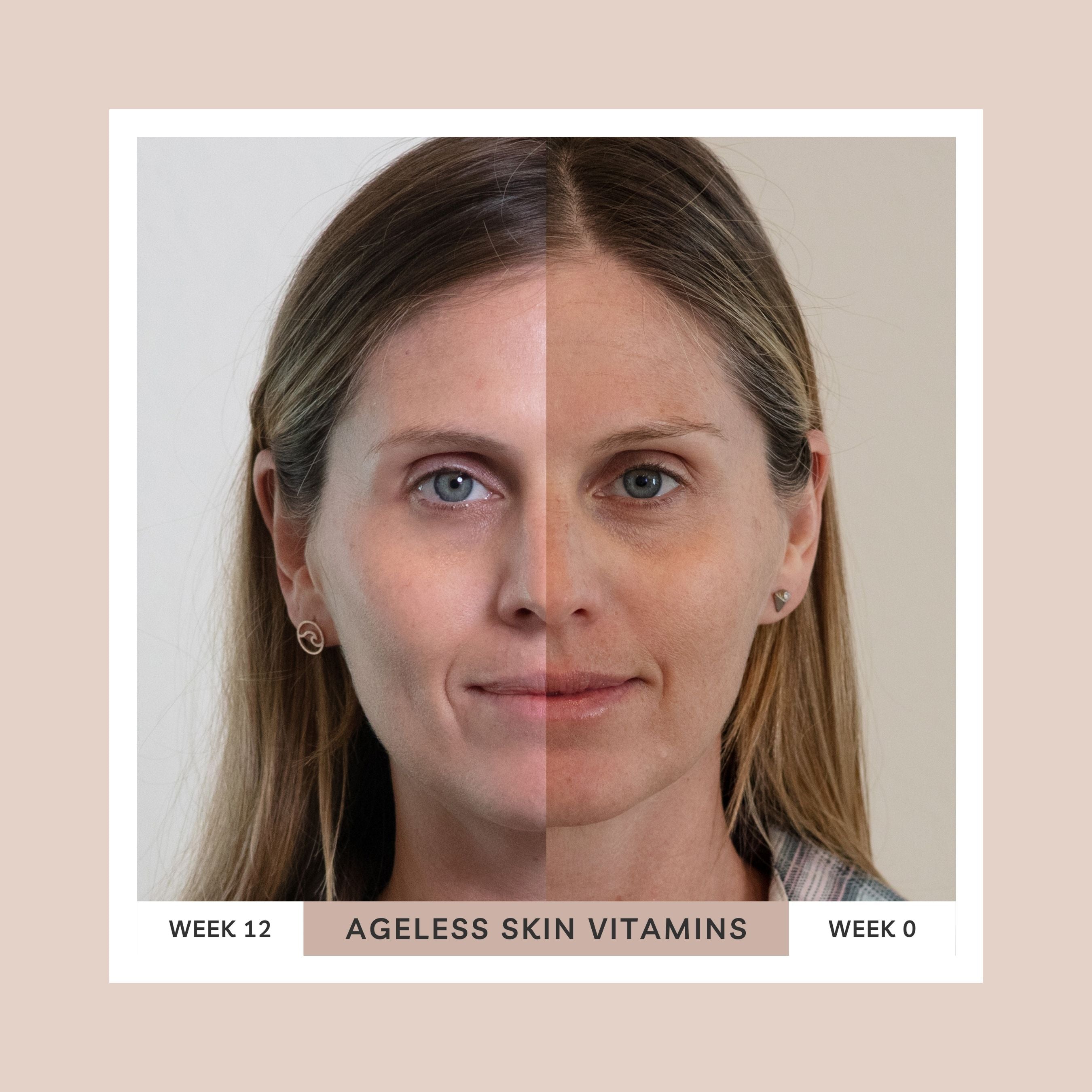 Ageless Skin Vitamins — Anti-Ageing Skin Supplement