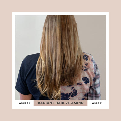 Radiant Hair Vitamins — Hair Growth & Shedding Support